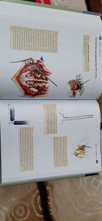 Pediatric Orthopaedics Lovell and Winter - Görsel 3