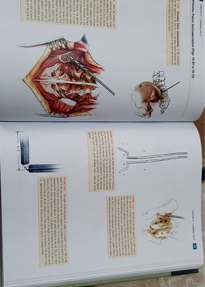 Pediatric Orthopaedics Lovell and Winter - Görsel 3