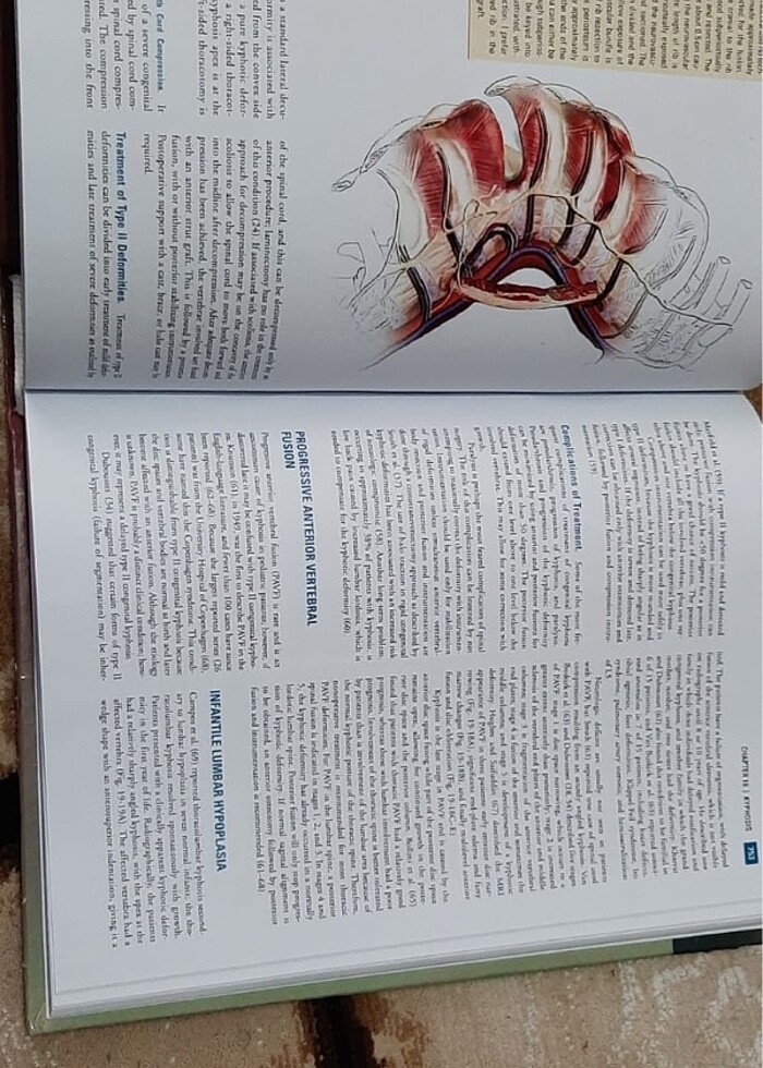 Pediatric Orthopaedics Lovell and Winter - Görsel 4