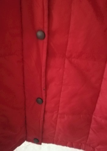 Alt dugme orda kucuk siyah leke var belli degıl - Görsel 4