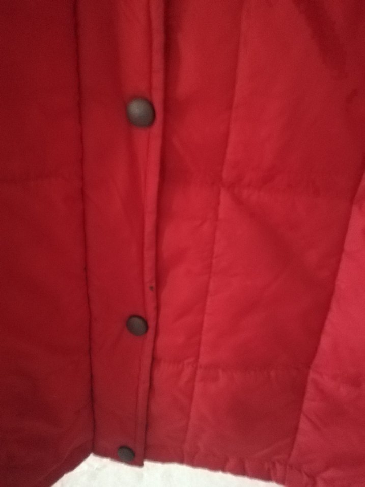 Alt dugme orda kucuk siyah leke var belli degıl - Görsel 4