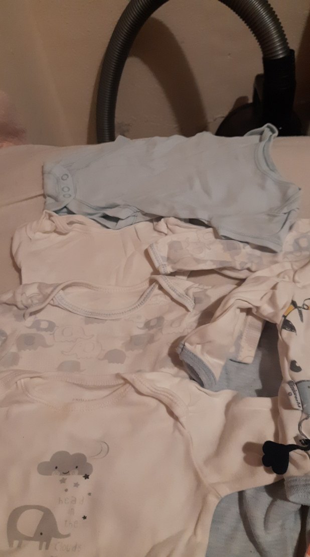 Gri Düğmeli Bebek Kısa Kollu Body - Görsel 2