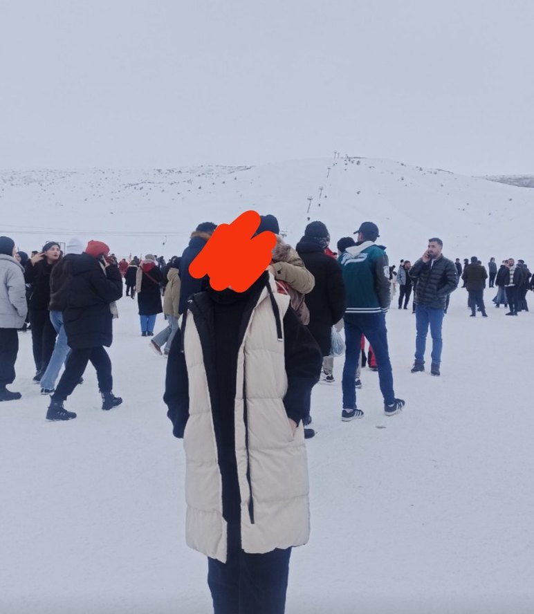 Kadın Beyaz siyah çift taraflı Midi Kışlık Kolsuz Yelek - Görsel 2