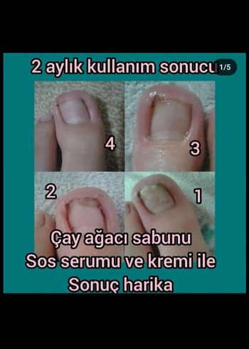 Farmasi Çay Ağacı Balsam - Görsel 7