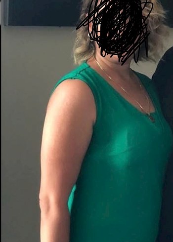 Drapeli V Yaka Yeşil Tulum - Görsel 2