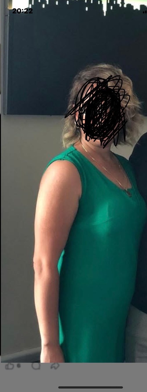 Drapeli V Yaka Yeşil Tulum - Görsel 2