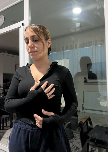 Siyah Kapüşonlu Fermuarlı Kadın Ceket - Görsel 2