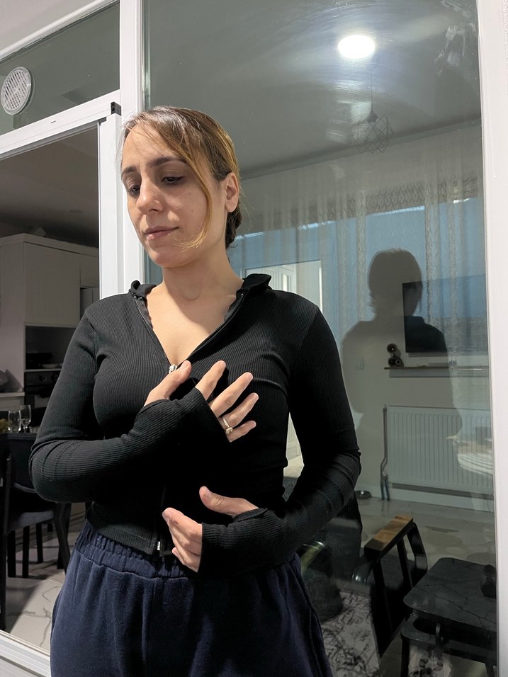 Siyah Kapüşonlu Fermuarlı Kadın Ceket - Görsel 2