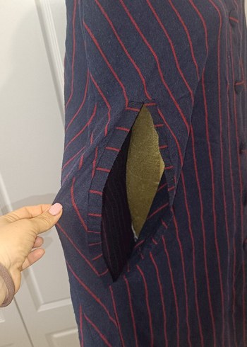 Çizgili, Düğmeli panço - Görsel 3