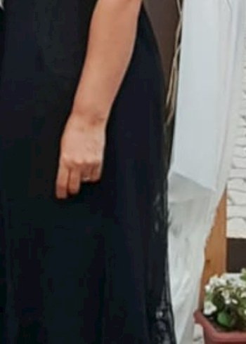 Siyah Dantel Detaylı Midi Özel Tasarım Abiye Elbise - Görsel 7