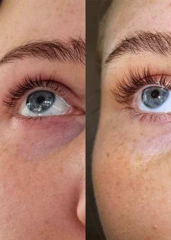 Sweed lash serum - Görsel 3