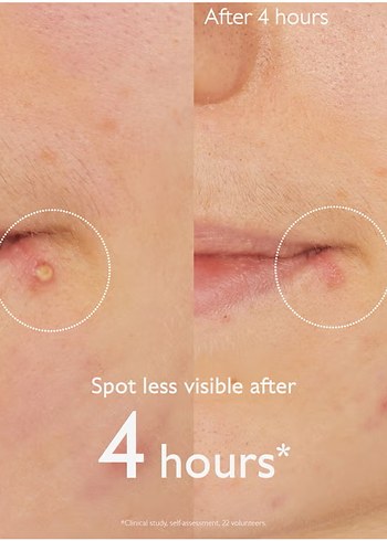 Caudalie salicylic spot solution - Görsel 3