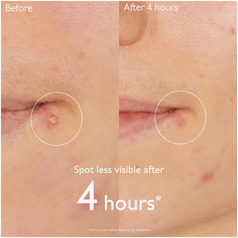 Caudalie salicylic spot solution - Görsel 3