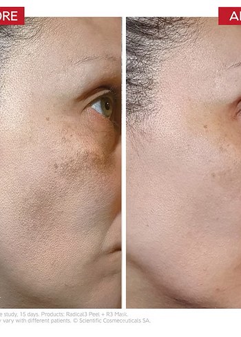 Dr. LEVY switzerland reboot pro peel - Görsel 6