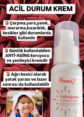 yaralar için krem