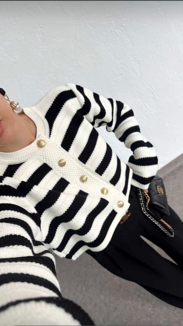 Zebra Desenli Düğmeli Kısa Hırka - Görsel 2