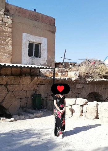 Günlük Elbise - Görsel 6