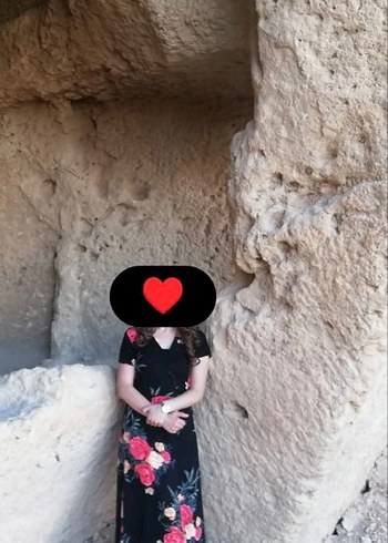 Günlük Elbise - Görsel 3