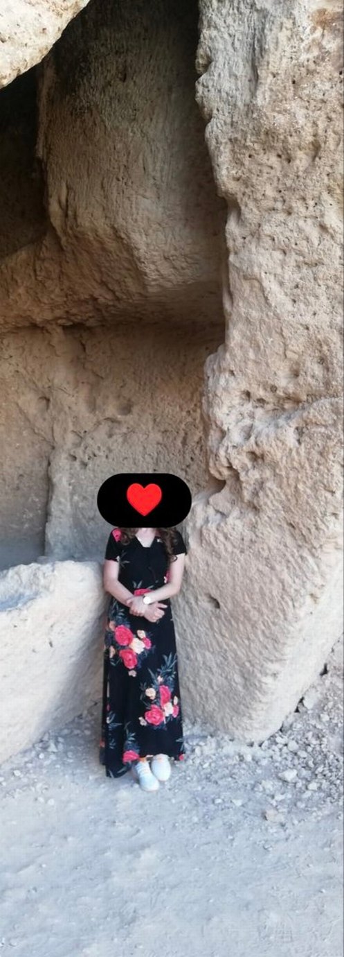 Günlük Elbise - Görsel 3