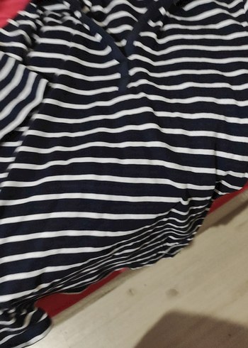 çizgili kadın dirsekte kolu pençesi çok güzel - Görsel 2