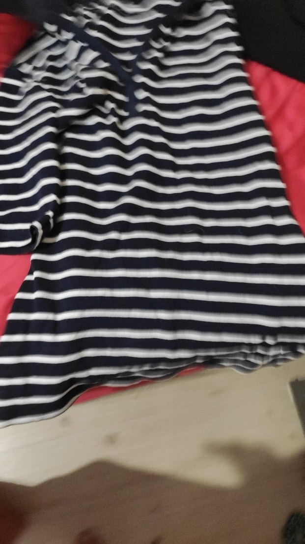 çizgili kadın dirsekte kolu pençesi çok güzel - Görsel 5