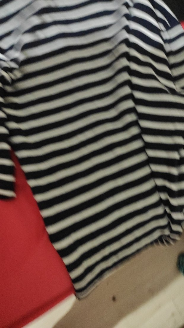 çizgili kadın dirsekte kolu pençesi çok güzel - Görsel 4