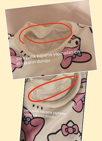 Yaka pislik kapama şerit ekstrafor balıksırtı 