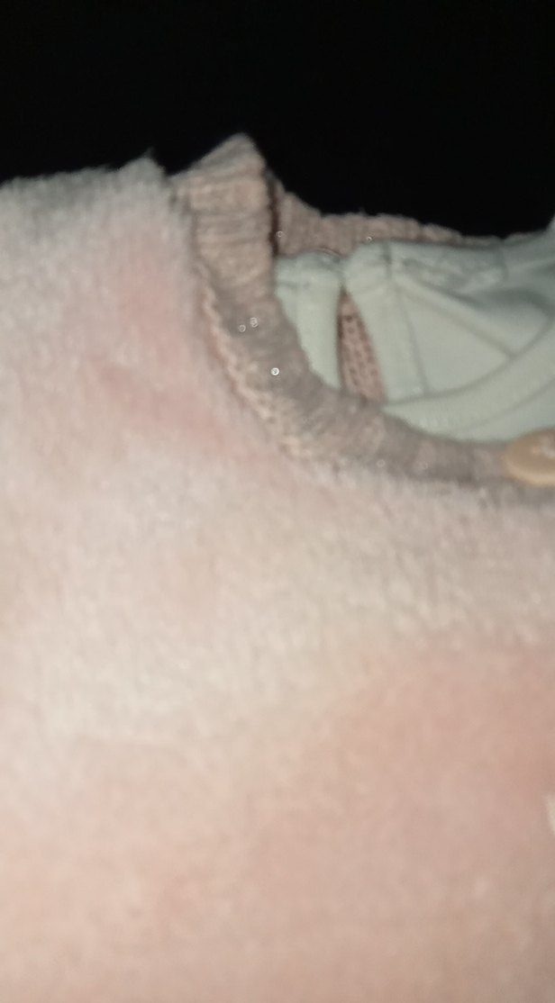 Kız Bebek Pembe Kürklü Yelekli Takım - Görsel 5