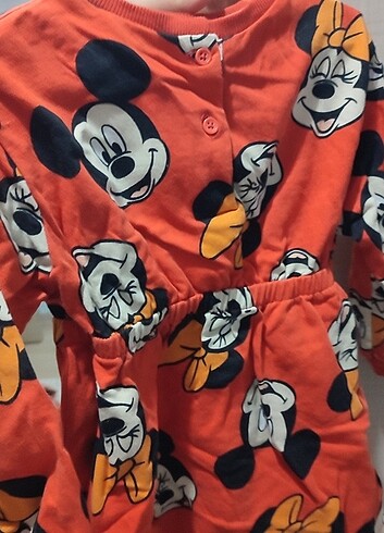 24-36 Ay Beden Mickey mouse elbise 