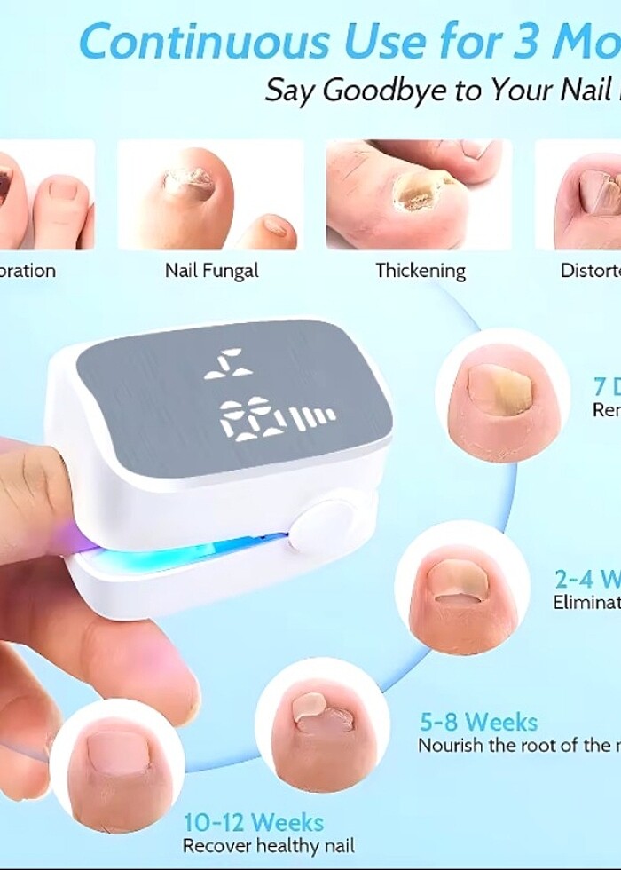 Tırnak mantar tedavisi lazer cihazı - Görsel 3