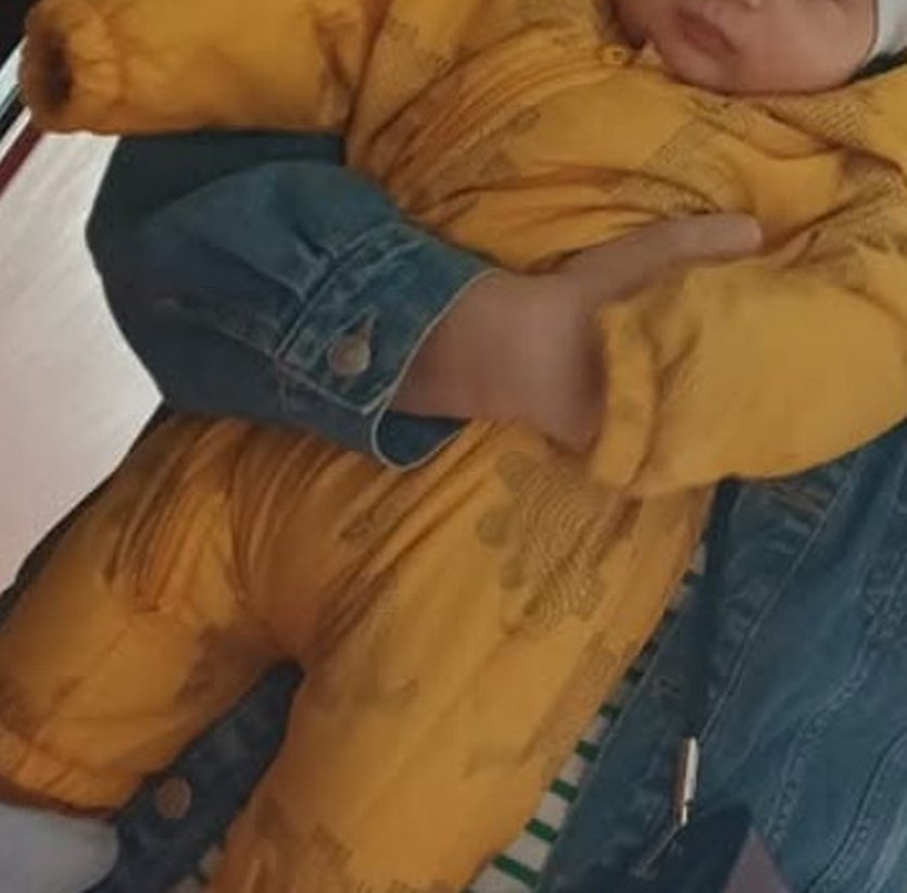 Sarı Fermuarlı Bebek Tulumu - Görsel 4