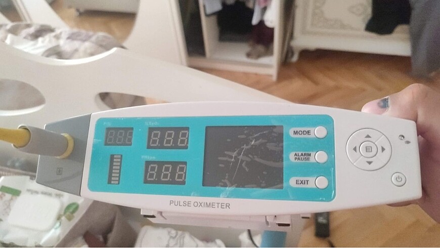 Satürasyon cihazı( pulse oksimetre )