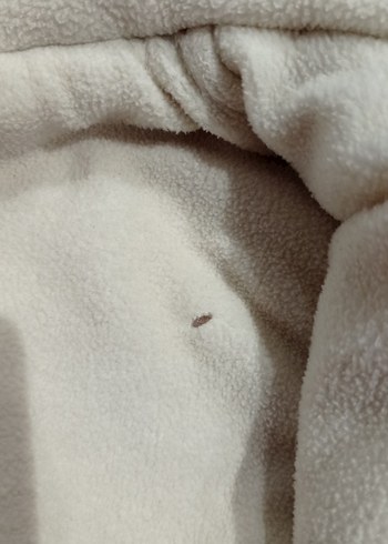 Pembe Kapüşonlu Bebek Kız Tulumu Kürklü - Görsel 9