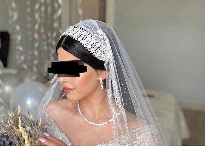 Zirkonyum gelin tacı