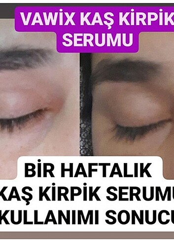 Kaş serumu  - Görsel 2