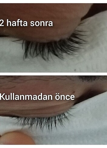 Kaş serumu  - Görsel 5