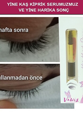 Kaş serumu  - Görsel 6