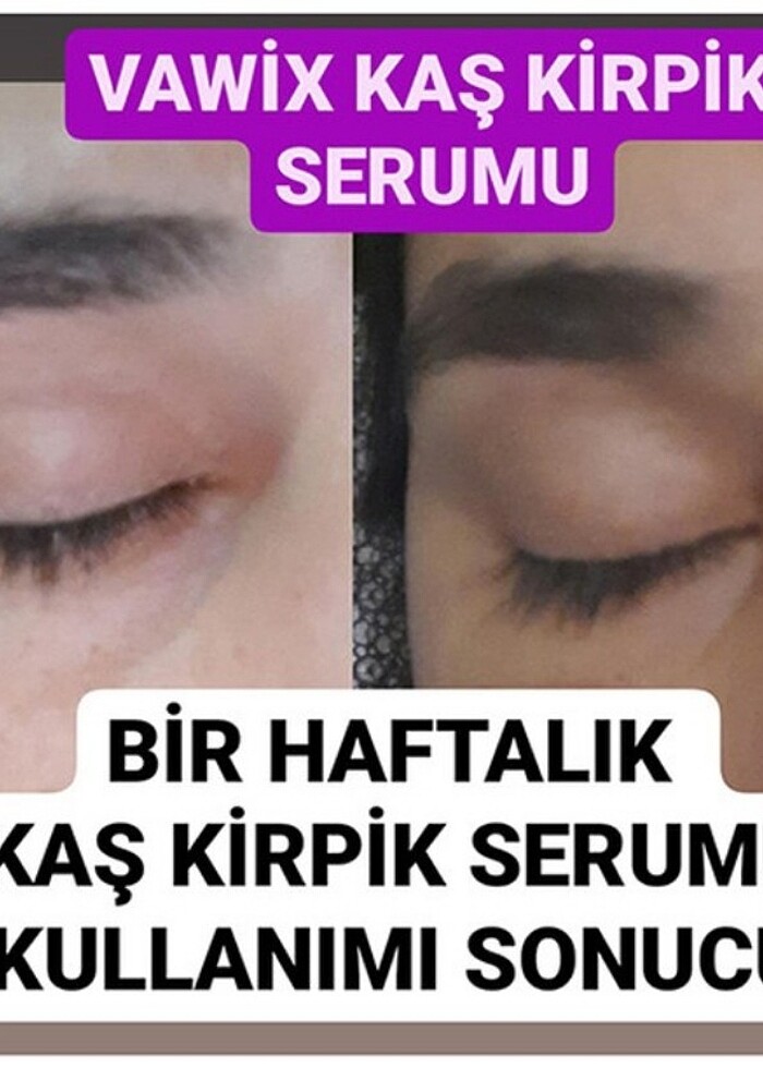 Kaş serumu  - Görsel 2