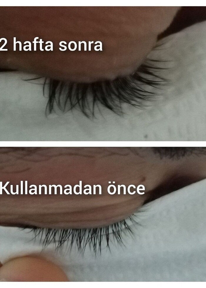 Kaş serumu  - Görsel 5