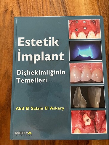 diş hekimliği estetik implant