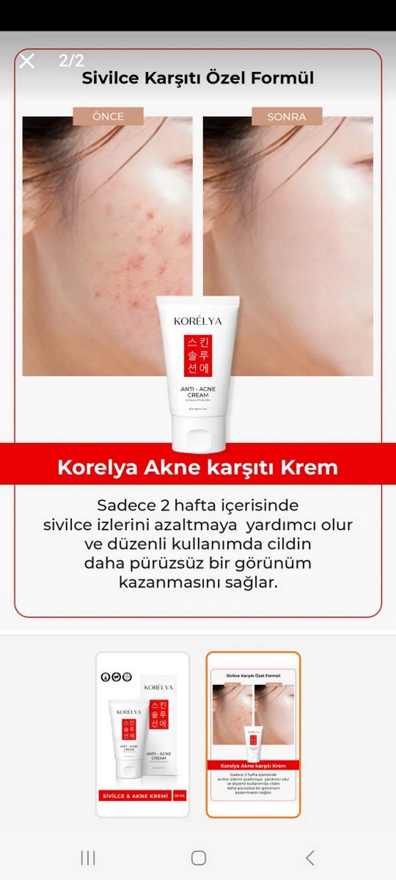 Korelya Anti-Akne Kremi - Görsel 2