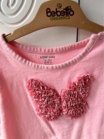 Bebek tulumu - Görsel 2