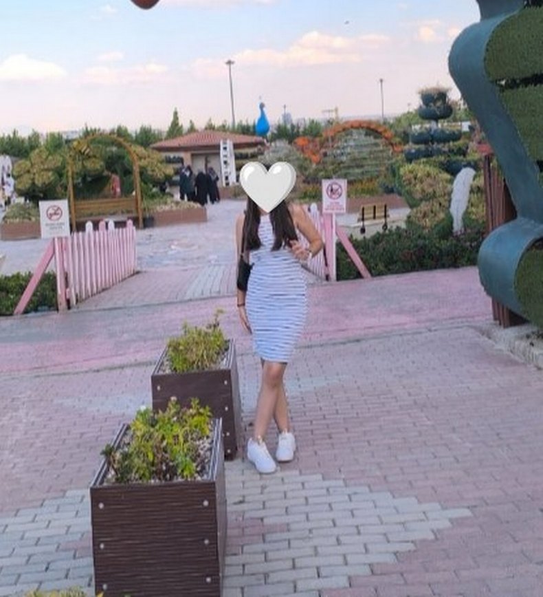 Çizgili Strappy Midi Elbise - Görsel 2