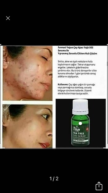 Mucize serum