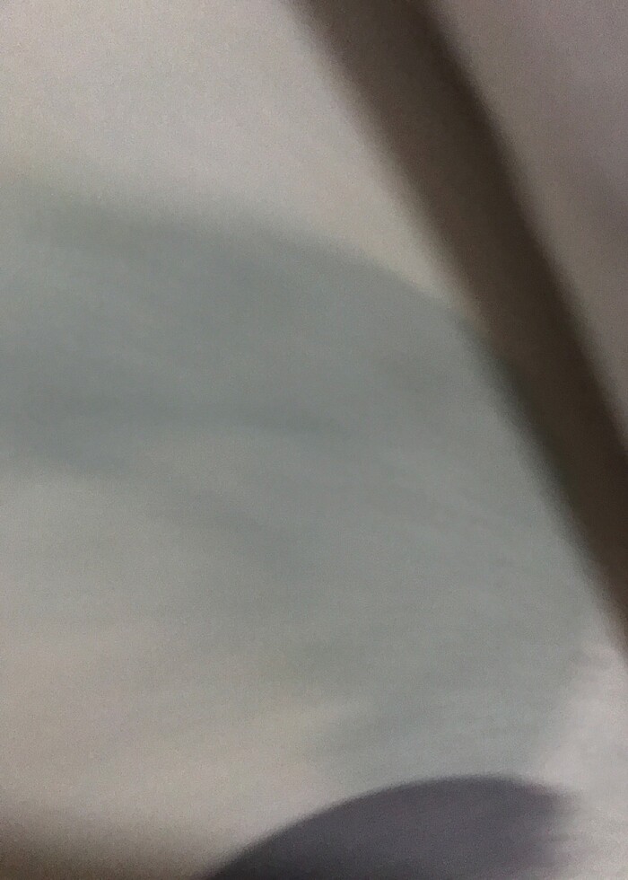 Bebek tırnak törpüsü - Görsel 4