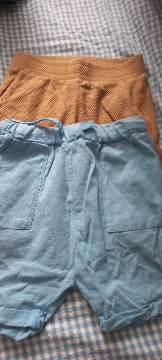 Mavi Kısa Kollu Bebek Hastane Kıyafeti - Görsel 4