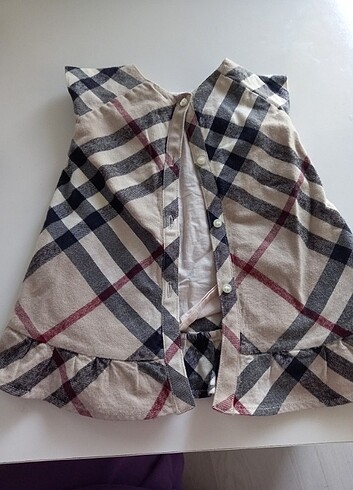 Burberry Elbise