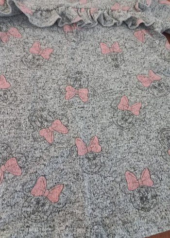 Gri Desenli Çocuk elbisesi - Görsel 2