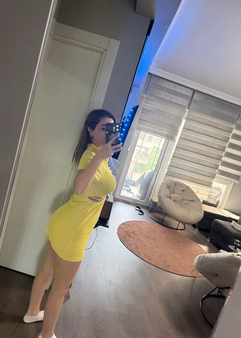 Sarı Şeffaf V Yakalı Mini Elbise - Görsel 3