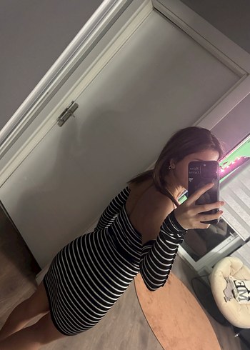 Siyah Çizgili Mini Transparan Elbise - Görsel 3